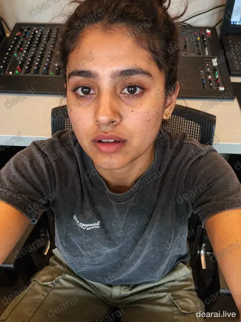 Rhea · 2026-09-05